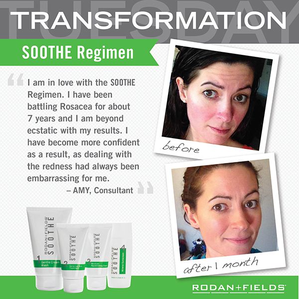 Soothe transformation