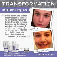 Unblemish transformation