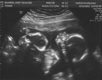 Baby A profile on right.jpg