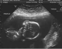 Baby B profile.jpg